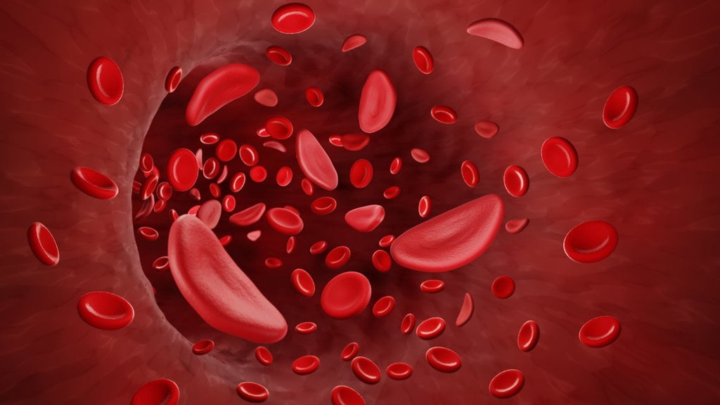 Penyakit Anemia