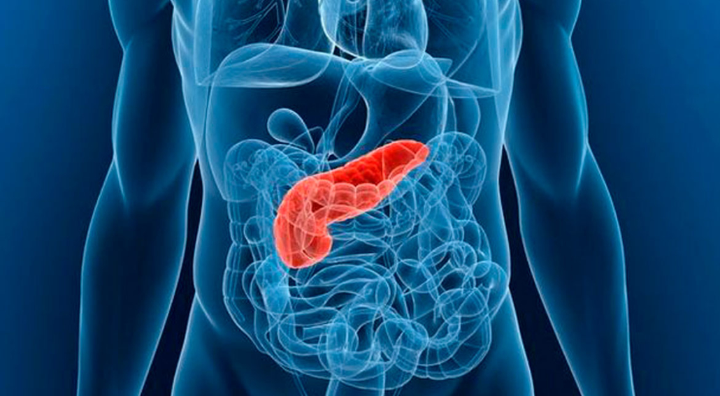 7 Cara Sederhana Merawat Pankreas Tanpa Obat